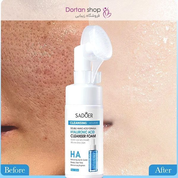 فوم شست‌وشوی صورت براش‌دار سادور حاوی هیالورونیک اسید | حجم 120 میل